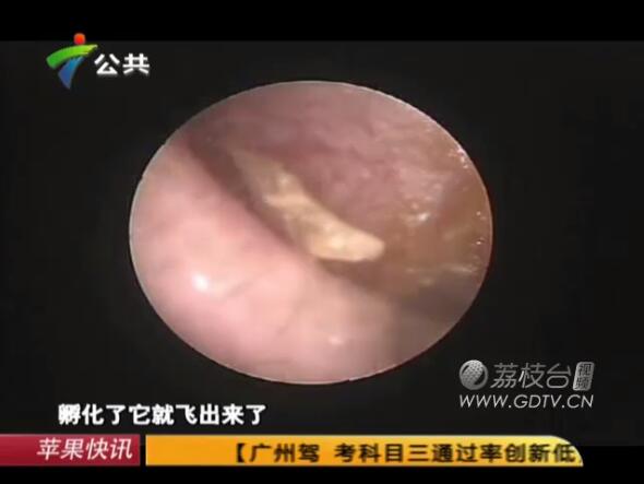 �@�֣����Ӷ���(n��i)�L(zh��ng)�M��ɫ���x��˺ҧ����ʹ��������